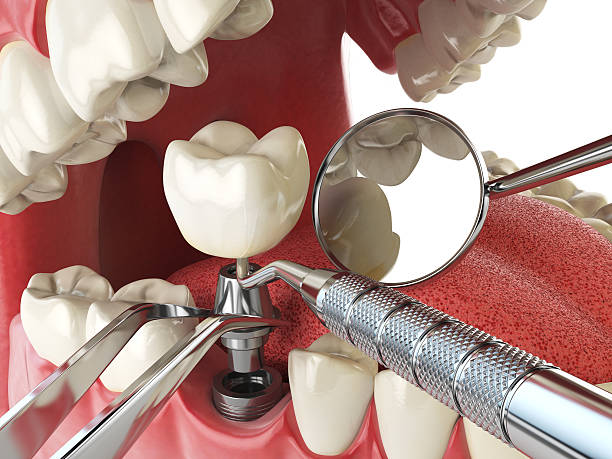 Best Emergency Dentist for Knocked-Out Tooth in Malvern, OH